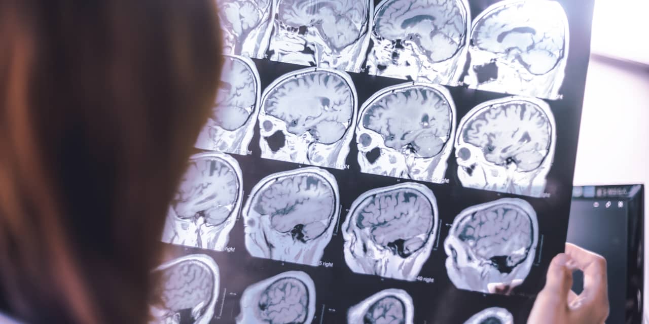 BIOGEN: JP Morgan Increases Price Target to $185, Up from $175