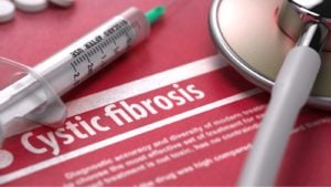 Axsome Therapeutics Q4 2025 Earnings Call Highlights